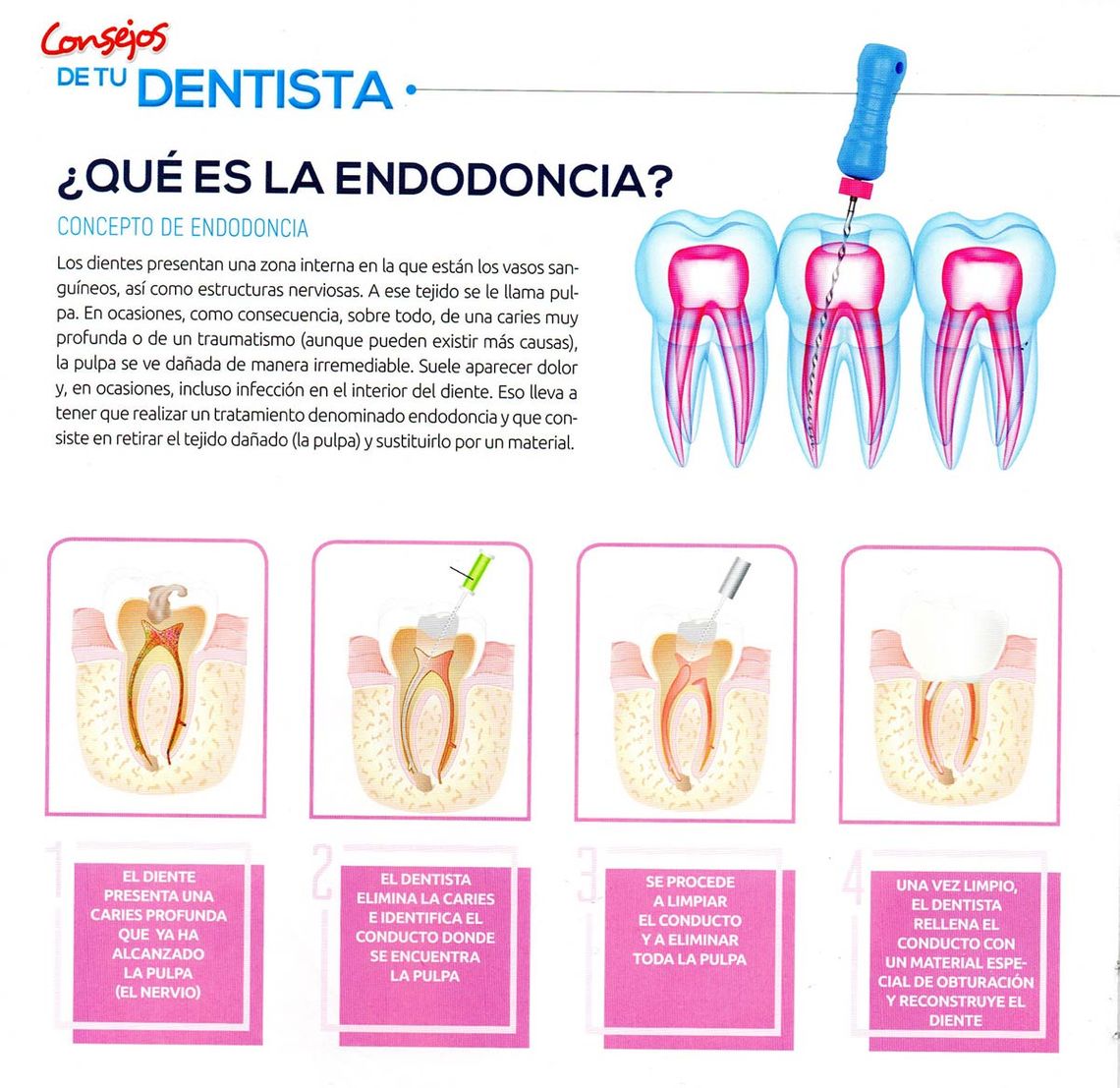 Clínica Dental M. V. Romero endodoncia