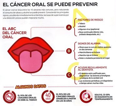Clínica Dental M. V. Romero cancer oral