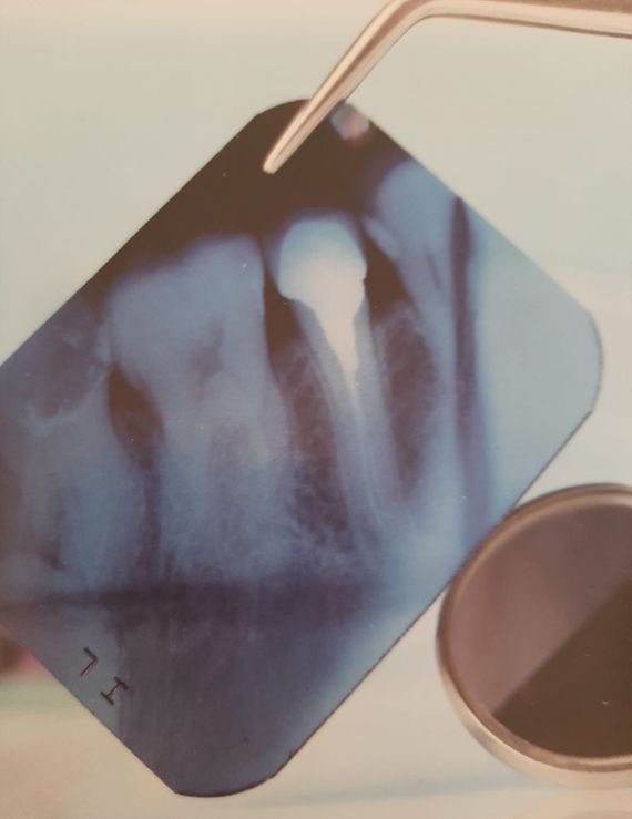 Clínica Dental M. V. Romero imagen radiografía